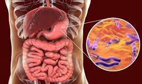 Online H Pylori Lab Testing